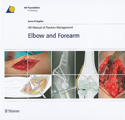 Ao Manual of Fracture Management - Elbow & Forearm