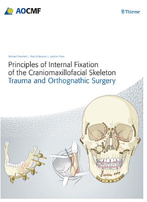Principles of Internal Fixation of the Craniomaxillofacial Skeleton: Trauma and Orthognathic Surgery