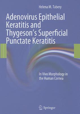 Adenovirus Epithelial Keratitis and Thygeson's Superficial Punctate Keratitis: In Vivo Morphology in the Human Cornea