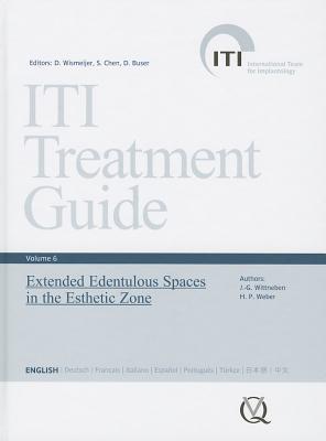 Iti Treatment Guide, Vol 6: Extended Edentulous Spaces in the Esthetic Zone