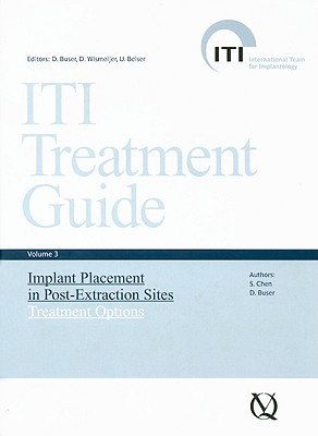 Iti Treatment Guide, Vol 3: Implant Placement in Post-Extraction Sites: Treatment Options
