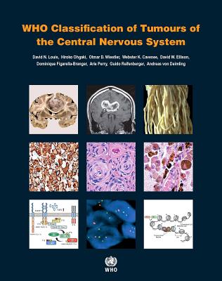 Who Classification of Tumours of the Central Nervous System [Op]
