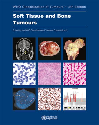 Soft Tissue and Bone Tumours: Who Classification of Tumours