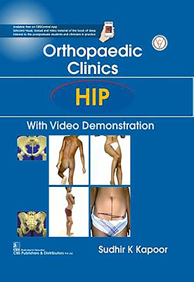 Orthopedic Clinics: Hip: With Video Demonstration