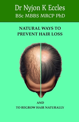 Natural Ways to Prevent Hair Loss: How to regrow hair naturally