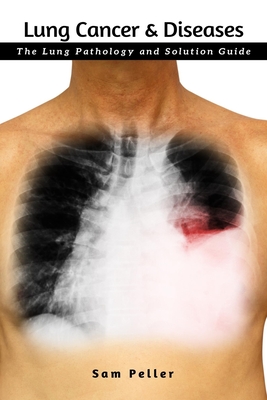 Lung Cancer & Diseases: The Lung Pathology and Solution Guide