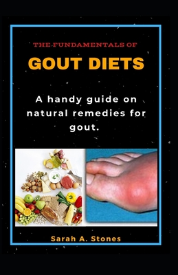 The Fundamentals of Gout Diets; A Handy Guide on Natural Remedies for Gout