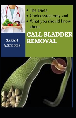 The Diets, Cholecystectomy, And What You Should Know About Gall Bladder Removal
