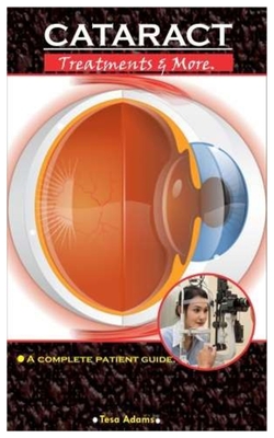 CATARACT. Treatment & More: A Complete Patient Guide