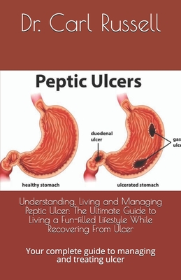 Understanding, Living and Managing Peptic Ulcer: The Ultimate Guide to Living a Fun-filled Lifestyle While Recovering From Ulcer: Your complete guide to managing and treating ulcer