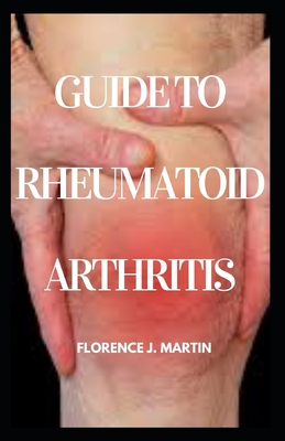 Guide to Rheumatoid Arthritis Diet: This explains dietary therapy for rheumathoid arthritis disease