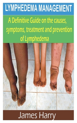 Lymphedema Management: A Complete Guide on the causes, symptoms, treatment and prevention of lymphedema