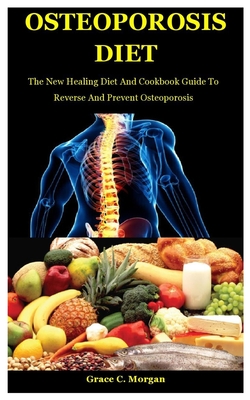 Osteoporosis Diet: The New Healing Diet And Cookbook Guide To Reverse And Prevent Osteoporosis