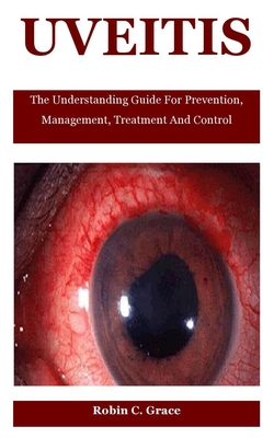 Uveitis: The Understanding Guide For Prevention, Management, Treatment And Control